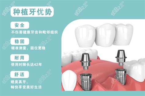 柳州种植牙多少钱一颗价格表2023,含种牙好的公私立医院名单 - 爱美容研社
