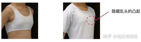 儿童胸部发育的事实与正确穿戴文胸的必要性 - 知乎