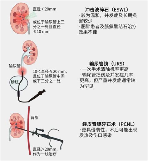 女性泌尿系统高清图片下载_红动网