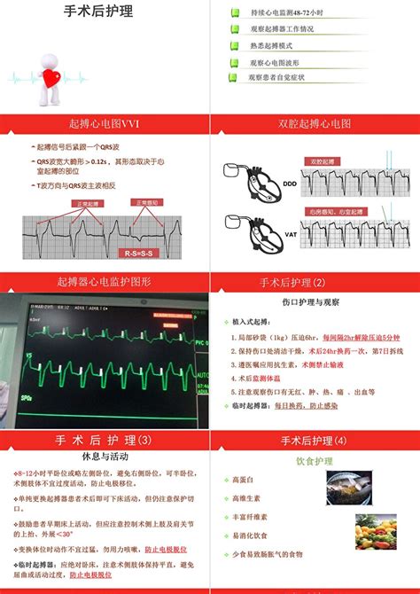 植入式心脏起搏器_上海聚慕医疗器械有限公司-药源网