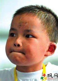 地震小英雄林浩这八年：与“小英雄”标签艰难磨合--教育
