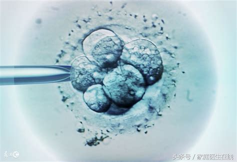 试管婴儿是指精子和卵子在体外进行受精后形成胚胎，再将胚胎直接移植进入母亲宫腔的过程。