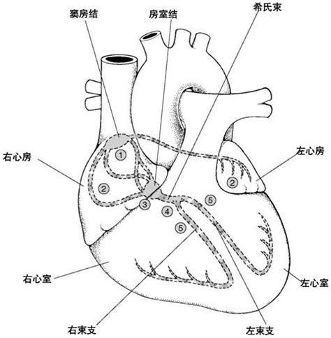 起搏器置入术 心脏中心