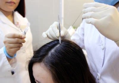 新款智能毛发分析仪头发测试仪毛囊头发 头皮检测仪高清一体机-阿里巴巴