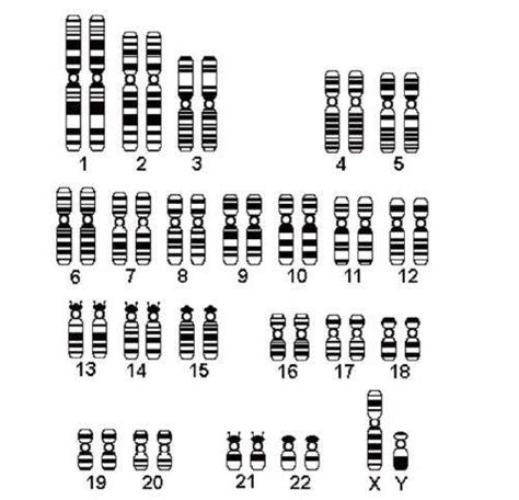 染色体异常是什么原因导致的？-香港Zentrogene基因检测中心(香港大Z化验所)【官网】