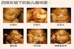 23周彩超检查胎儿鼻骨标准正常值是多少_第二人生