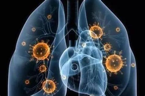 新型冠状病毒肺炎和普通感冒、流感如何区分？一张表格教你判断！_健康必读_健康之路