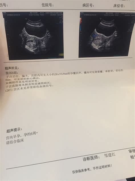 已生男孩孕囊图片分享：根据数据和形状看男女真的很准_家庭医生在线