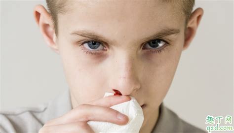 孩子常流鼻血正常吗 孩子常流鼻血该怎么解决-趣丁网