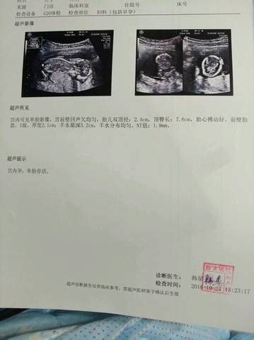 怀孕B超单生成器