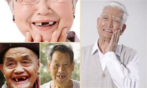 70岁老人适合种牙还是镶牙？详解镶牙和种植牙有什么区别哪个好_口腔行业资讯_皓齿口腔网