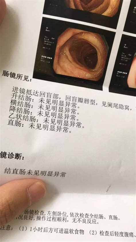 粉丝来信：忍痛做完“直肠指检”后，医生为何还建议做肠镜检查？__财经头条