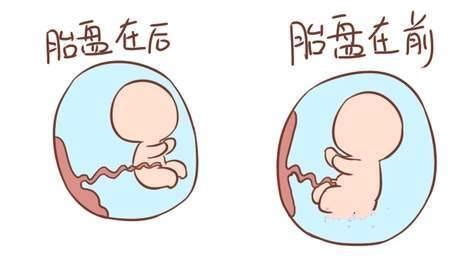 怀孕时，胎儿位置在前壁或者后壁有什么区别？风险程度大不同|胎盘|后壁|胎儿_新浪新闻