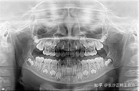 牙体解剖应用名称|综合病例|陕西嘉友科贸有限公司