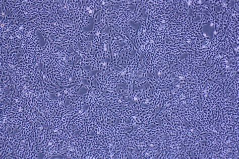图1～10 间期细胞核(电镜照像)-功能组织学与胚胎学-医学