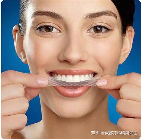 浅析洗牙、美白牙贴、冷光美白、牙齿贴面四种牙齿美白方式的区别！ - 知乎
