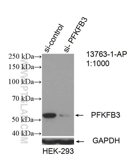 PFKFB3-Specific Antibody 13763-1-AP | Proteintech