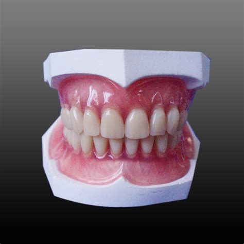 固易美数字化全口义齿-胶托类-云南家红齿科技术股份有限公司