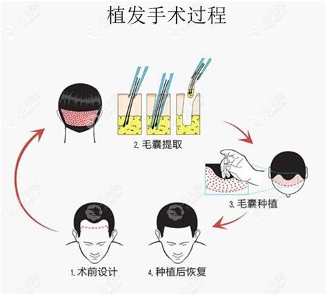 化妆品oem中国,毛囊完整的结构功能及相关疾病[水信生物]