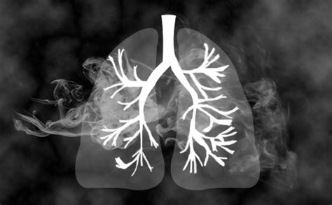 例8 肺鳞癌伴胸膜转移瘤-特种医学-医学