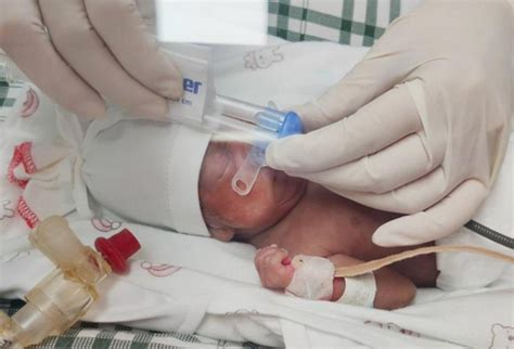 出生时仅22周6天，四川最小胎龄宝宝出院，取名恩恩！_四川在线