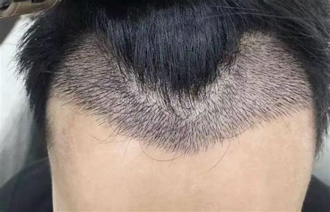 发际线高且M型发际线的男人适合什么发型？额头较大? - 知乎