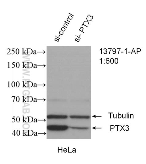 Pentraxin 3 Antibody 13797-1-AP | Proteintech