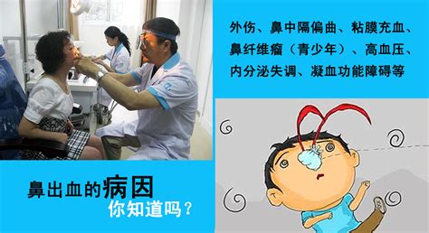 经常流鼻血是为什么_重庆耳鼻喉医院_重庆耳鼻喉医院哪家好 ...