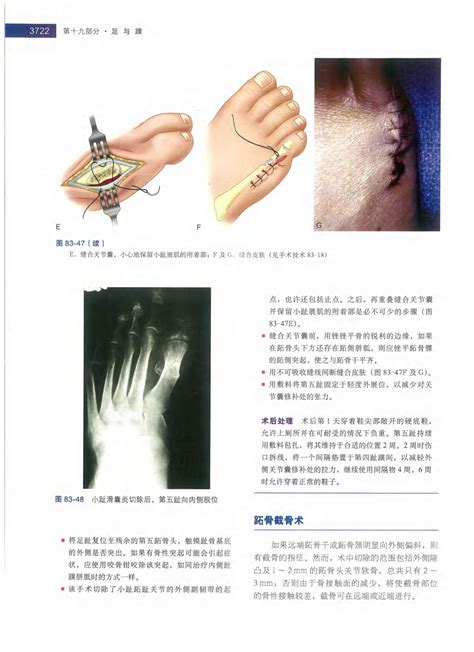 坎贝尔骨科手术学（第12版）第8卷：足踝外科_文库-报告厅
