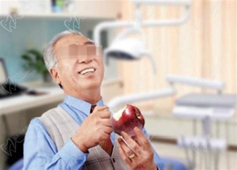 上海种植牙需要多少钱？_种植牙_诊疗项目_雅悦齿科