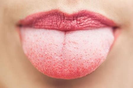 舌头发麻是什么原因？这四个原因导致别视而不见 _症状