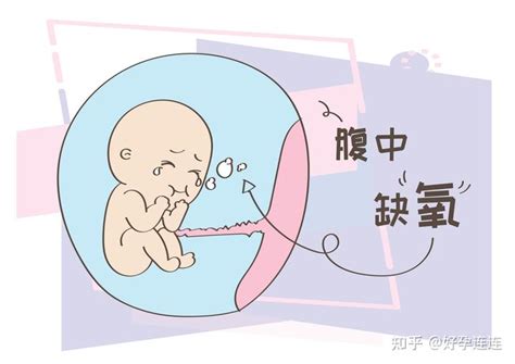怀孕后不要有这四个习惯，当心导致胎儿缺氧 - 知乎