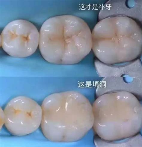 资深牙医良心解释：为何看牙贵-健康界