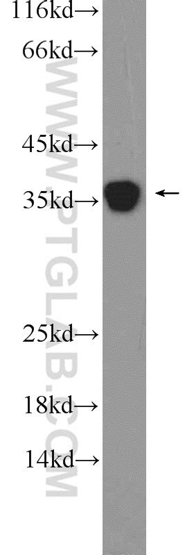 GADD45A Antibody 13747-1-AP | Proteintech