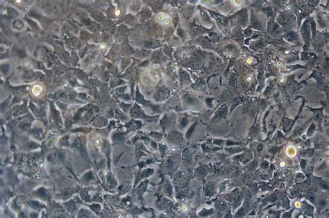 Hep 3B细胞ATCC HB-8064细胞 Hep3B人肝癌细胞株购买价格、培养基、培养条件、细胞图片、特征等基本信息_生物风