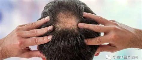 Cell子刊：科学家发现驱动毛发生长的关键信号分子，为治疗脱发带来新希望_毛囊_研究_真皮