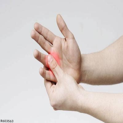 手指筋疼如何缓解 手指筋疼可用三个方法缓解_有问必答_快速问医生
