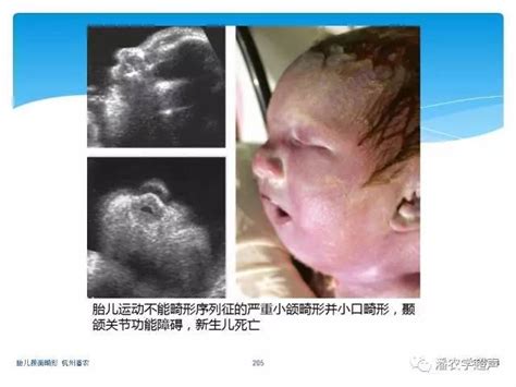 中国畸形婴儿处理办法（我国每年新生畸形儿近百万）-幼儿百科-魔术铺