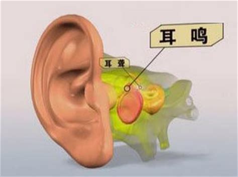 耳鸣是怎么回事_耳鸣的原因及治疗_生活百科_太平洋家居网