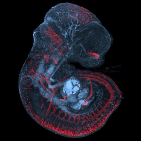 孕肚光照暴露对胎儿大脑发育很重要 - 生物通
