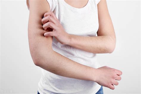 为什么总是发生过敏性荨麻疹？提示：日常做好3点，皮肤越来越好
