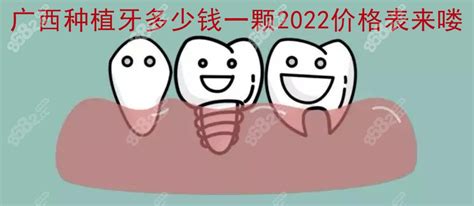 2022全国各地种植牙价格表来了!最便宜种一颗牙只要3000元 - 爱美容研社