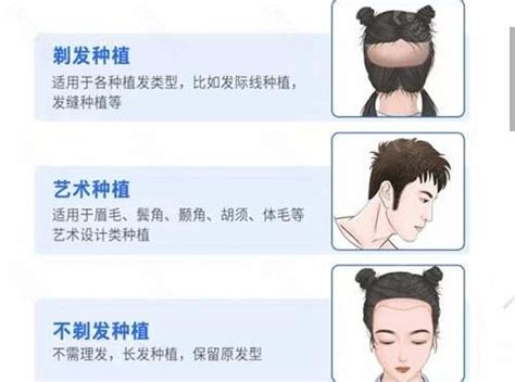 2021北京十大植发三甲医院排名发布,均是植发最好的公立医院 - 爱美容研社