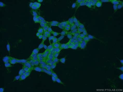 PAK6 Antibody 13539-1-AP | Proteintech