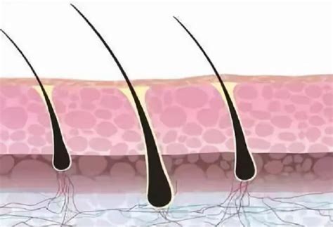 头发的主要成分是什么？少补一种都可能会导致脱发 | 说明书网