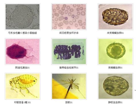 寄生虫图谱大全|寄生虫|蠕虫卵|图谱|检验|-健康界