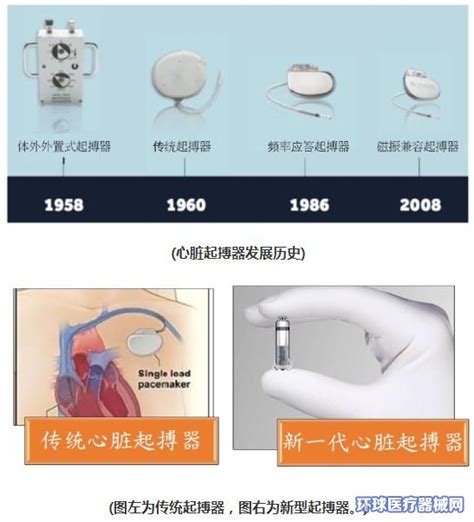 【植入新篇章】配套电极全，术后有保障-国产新型全自动心脏起搏器在云南省第一人民医院完成植入 -- 严道医声网