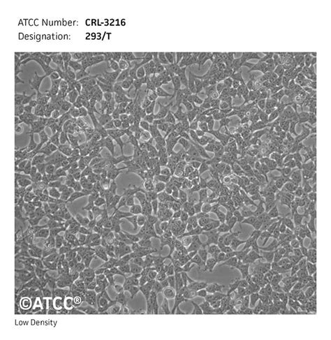 HEK-293T细胞ATCC CRL-3216细胞 HEK293T人体肾脏细胞系株购买价格、培养基、培养条件、细胞图片、特征等基本信息_生物风