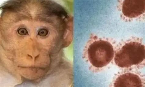 重庆市发现1例境外输入猴痘病例 关于猴痘这些你需要知道_新闻频道_中华网