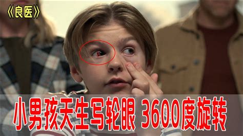 男孩天生写轮眼，能3600度旋转，但却使用过度双目失明《良医》_腾讯视频